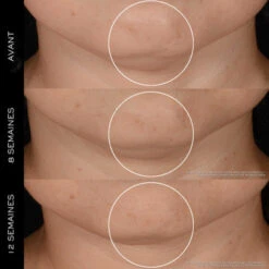 Lancome Rénergie H.P.N. 300-Peptide Crème Anti-Âge Haute-Performance 11 Lancome Rénergie H.P.N. 300-Peptide Crème Anti-Âge Haute-Performance -Célèbre Cosmétiques Magasin renergie hpn 300 peptide 3